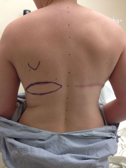 lat-flap-number-two