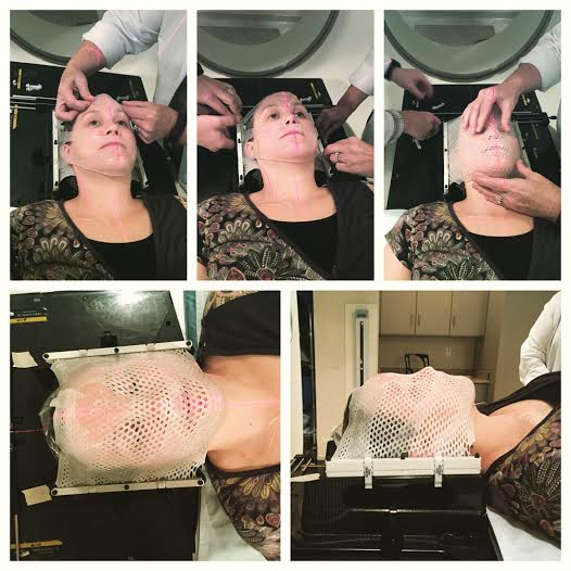 The mask making process for my SRS treatment. No bacon is making it in my mouth during this process.