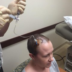 Chemo in my Braaaaiiiinnnsss